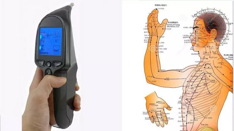 Акупунктурный аппарат Восточный лекарь 5